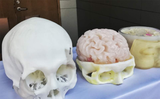 三维扫描及3D打印技术在医疗康复辅具中的应用